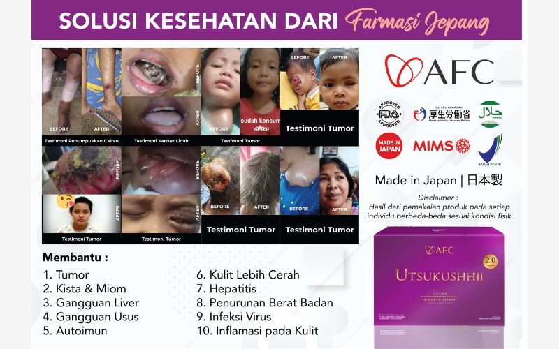 Testimoni Utsukushhii