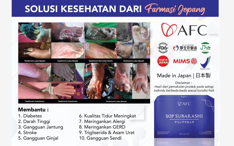 Testimoni SOP Subarashi